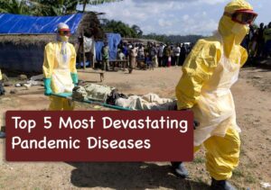 Top 5 Most Devastating Pandemic Diseases